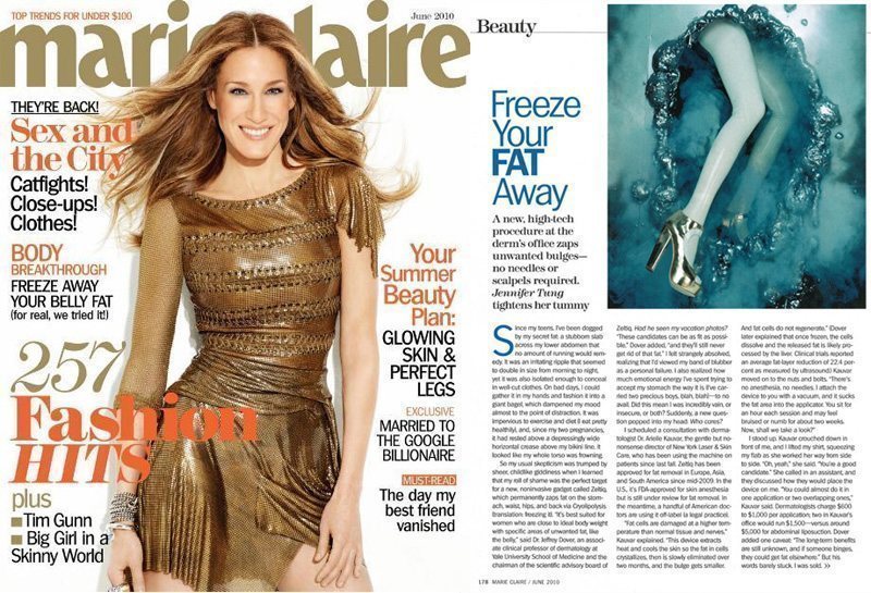 Marie Claire Magazine coolsculpting article