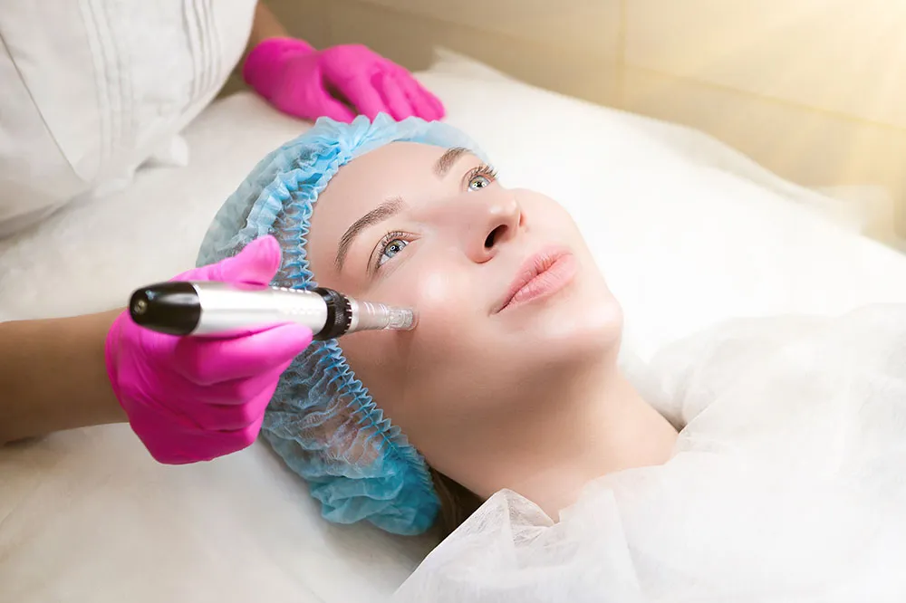 Microneedling facial treatment in progress. 
